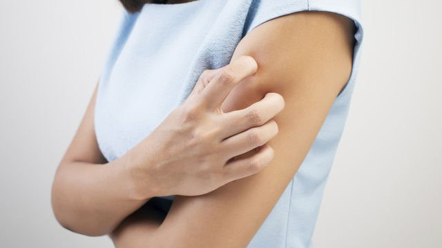 Hiện tượng ngứa và phát ban cũng xảy ra do bệnh thận