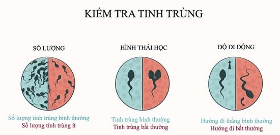 Bia rượu khiến tinh trùng yếu vận động kém
