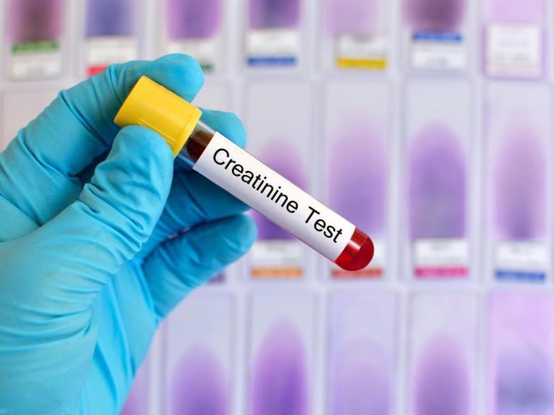 Creatinin là một dạng chất thải có trong máu của cơ thể