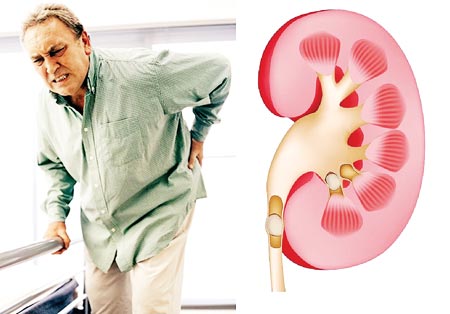 Người cao tuổi thường mắc các bệnh về thận